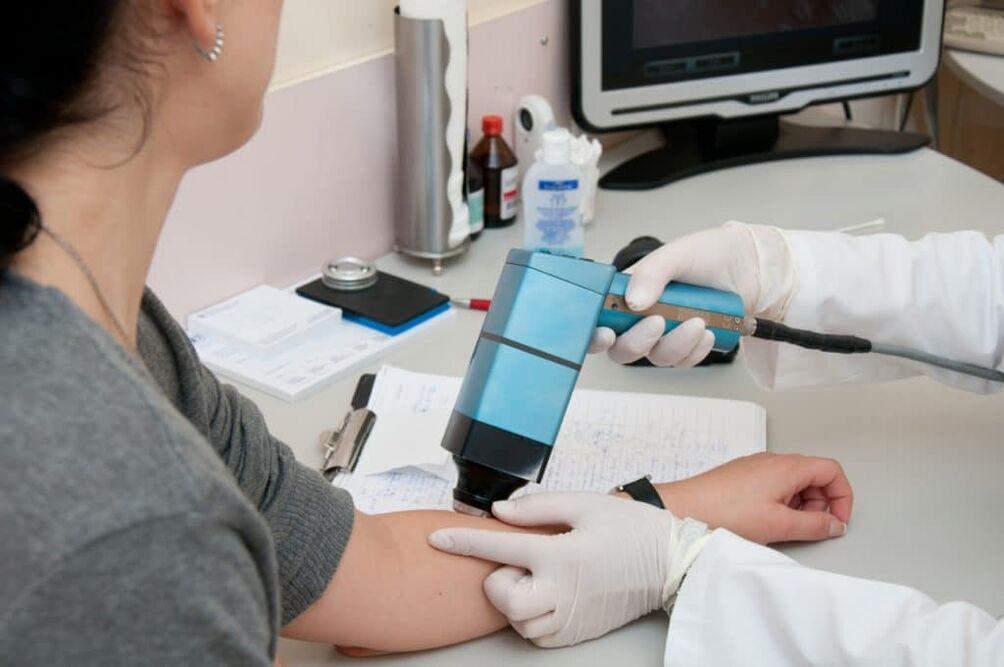 kūno karpų gydymo metodai