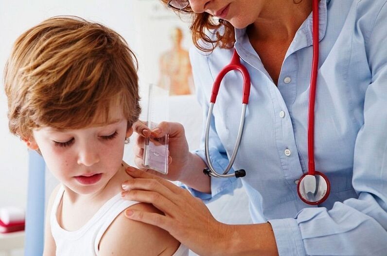 gydytojas apžiūri vaiką su papiloma ant kūno